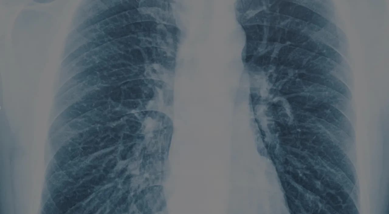 The Thorax by Valéria A Ferreira